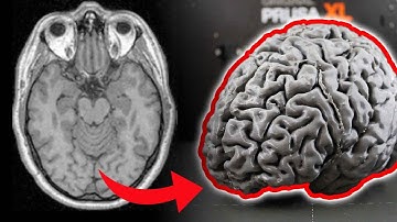 I turned an MRI into a 3D printable brain... here