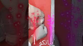 عرق التربيانكو.(اللحمه البارده)