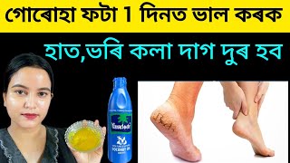 এদিনত গোৰোহা ফটা,হাত, ভৰি ফটা, শুকান ছাল দুৰ হব ছাল বগা উজ্বল হব জিলিকি উঠিব ।।