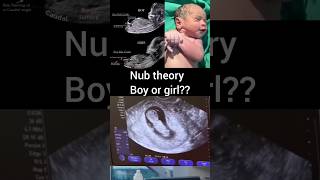 Nub Theory Boy Or Girl?