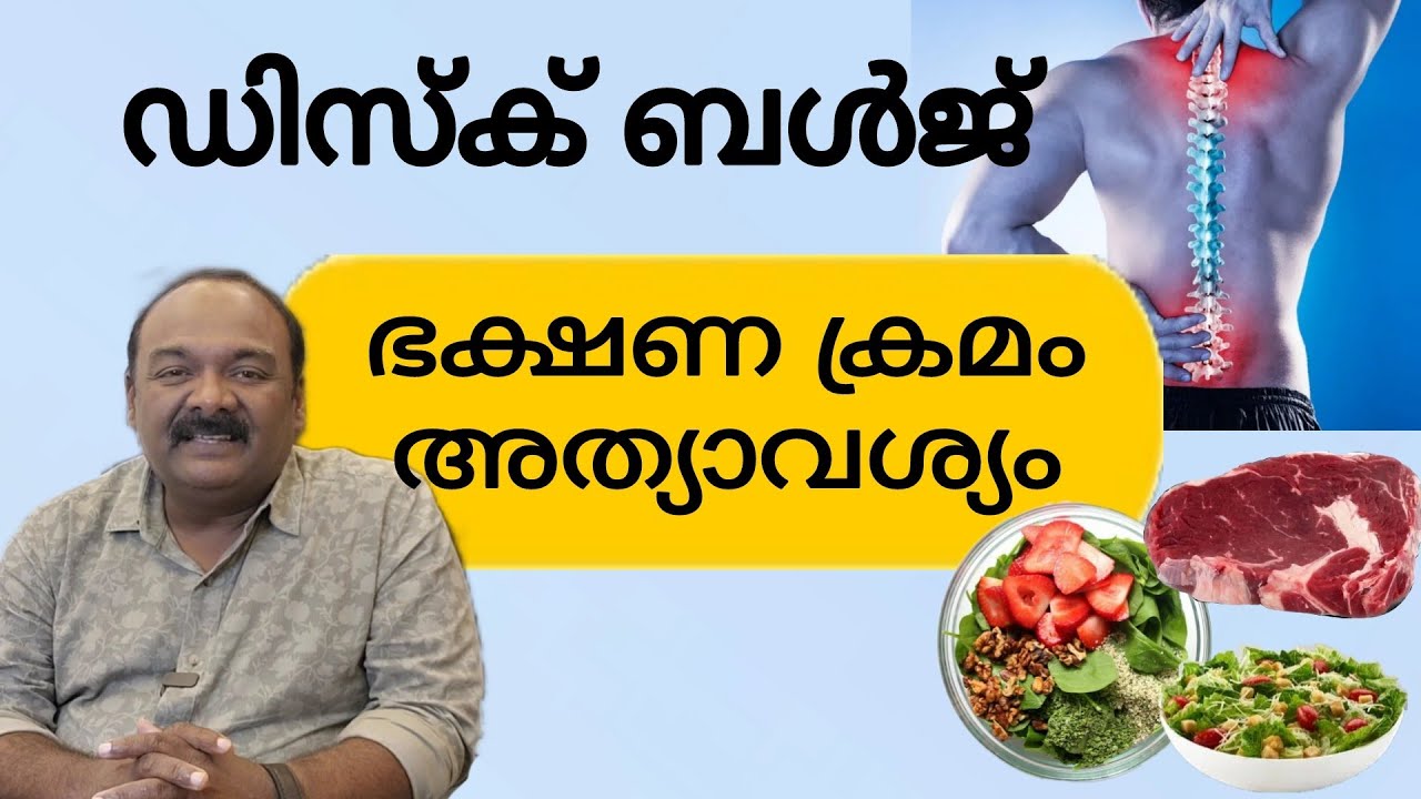 ഡിസ്ക് ബൾജ് ഉള്ളവർ നിർബന്ധമായും പാലിക്കേണ്ട ഭക്ഷണക്രമം