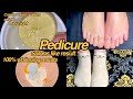 Pedicure at home tan removal  feet whitening removed cracked heels overnight 100 results