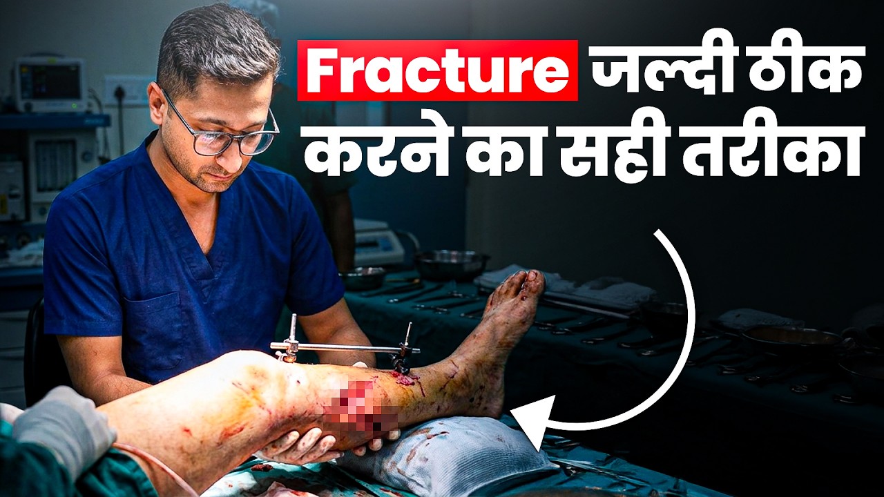 Fracture जल्दी कैसे ठीक करें? | AIIMS Doctor Reveals Bone Healing Secrets