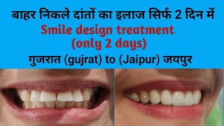 गुजरात (gujrat) से आये मरीज के बाहर दांतो का इलाज सिर्फ 2 दिन में // Smile design treatment// Smile
