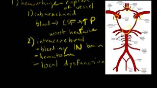 Stroke: Pathophysiology