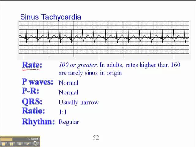 sinus tachycardia magas vérnyomással)