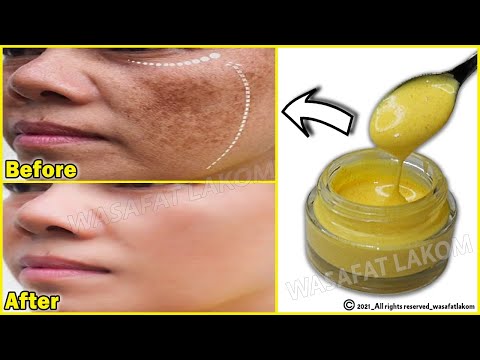 Magical Turmeric Cream | In 3 days it removes pigmentation, dark spots, freckles and treats melasma