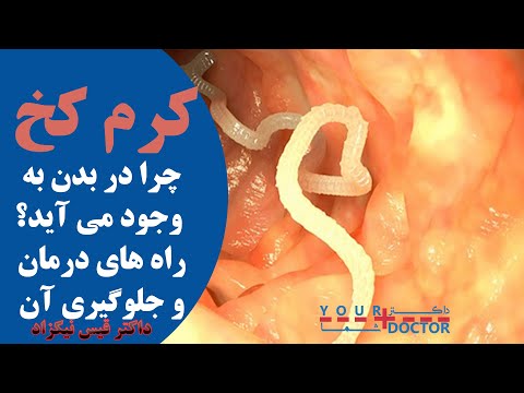 تصویری: آیا سفید کننده کرم سنجاق را از بین می برد؟