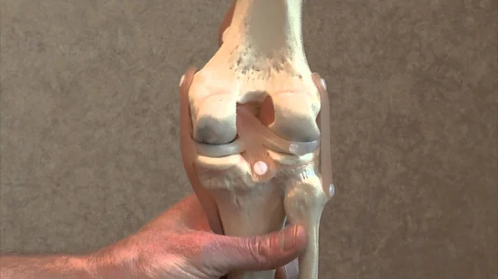 Describing Knee Pain: Where it's Located and What ...