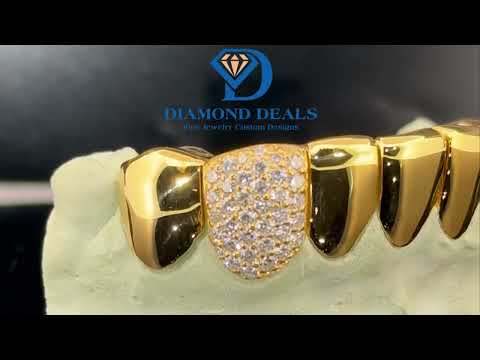 Diamond & Solid Grillz