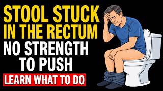 Stool STUCK in the Rectum! What is it and what to do Doctor Explains