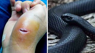 20 Most Venomous Snakes in the World You Wont Believe Actually Exist