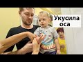 VLOG: Вову укусила оса