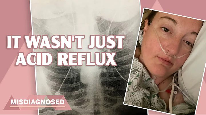 Doctors Dismissed Me And Said It Was Acid Reflux | Misdiagnosed | Health