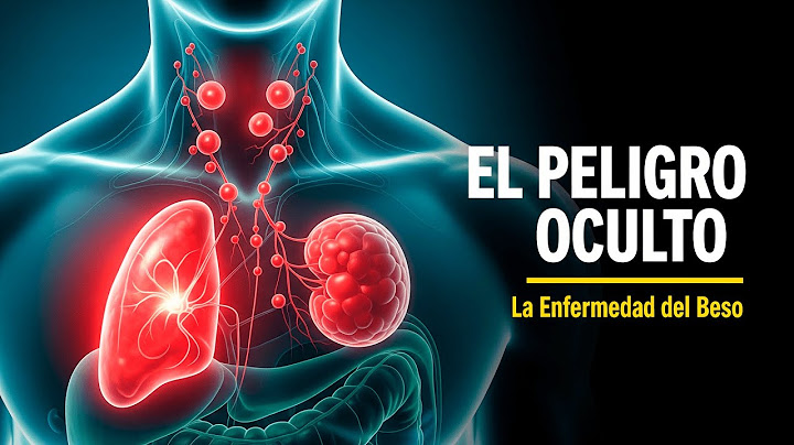 La Enfermedad del Beso (Mononucleosis): El Peligro Oculto del Bazo (Explicación Médica)