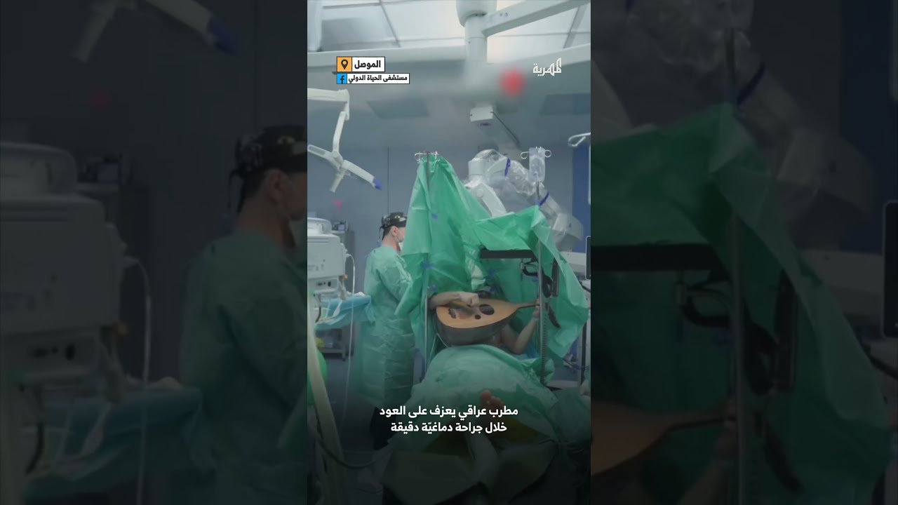عراقي يعزف على العود أثناء عملية جراحة دقيقة في الدماغ