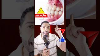 “Como é feita a contenção removível ideal?Observe o vídeo e fique atento! #ortodontia