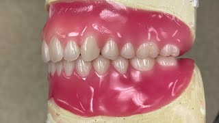 🔴LIVE: Teeth setting: تنضيد اسنان #waxbae #dentures #wax