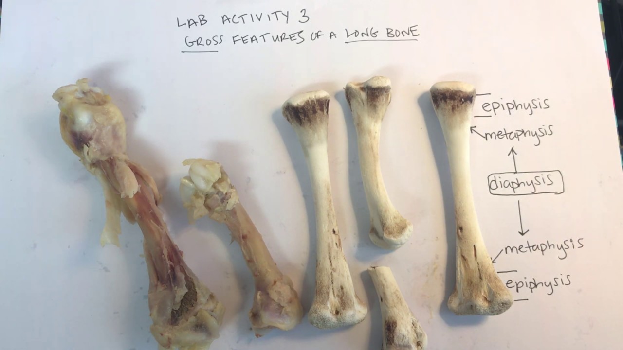 Anatomy Chicken Leg Bone Vrogue co swatting-is-real-and-dangerous-bill-burr-went-woke-tren-de-aragua