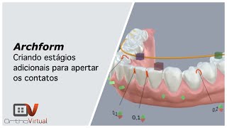 Archform - Criando estágios adicionais para apertar os contatos