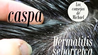 Caspa seca y dermatitis seborreica. ¿Qué son y cómo eliminarlas?