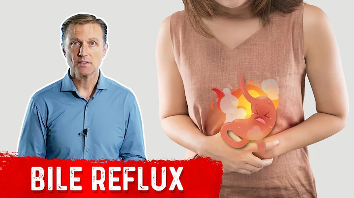 What is Bile Reflux?