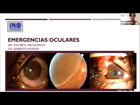 Vídeo: Emergencias Oculares: Tipos, Síntomas Y Prevención