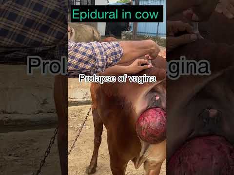 Epidural injection in cow l prolapse of vagina l dr umar khan