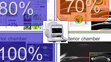 AECOS 2017 presentation by Dan Reinstein on the ArcScan Insight 100