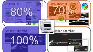 AECOS 2017 presentation by Dan Reinstein on the ArcScan Insight 100