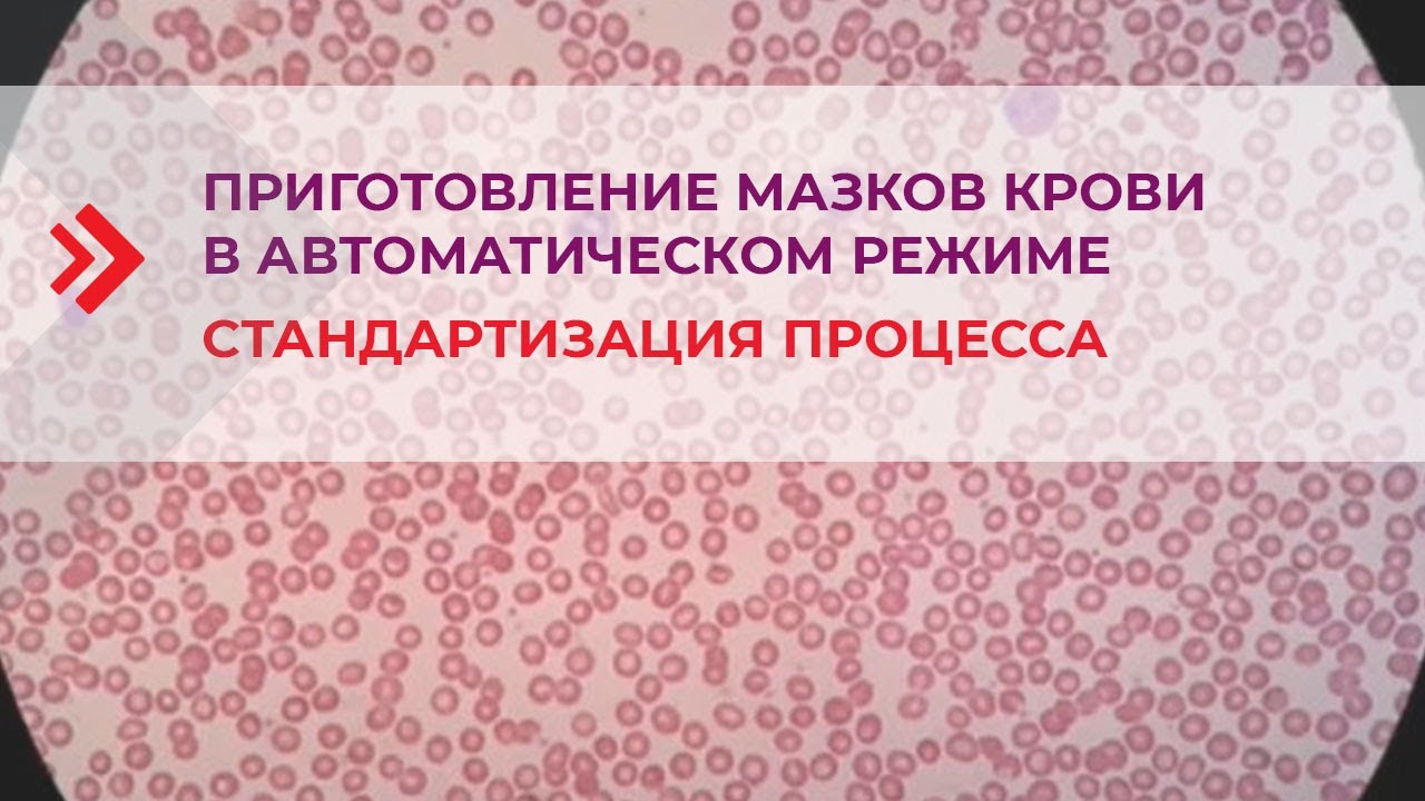 Приготовление мазков крови в автоматическом режиме – стандартизация ...
