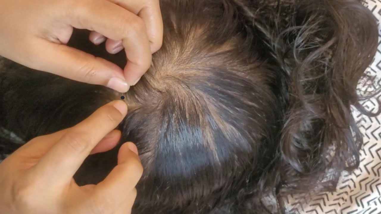 🤯 ULTIMATE SCALP CHECK ASMR: Tingles SO STRONG You'll INSTANTLY Sleep! 😴