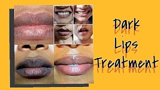 LIP CARE ROUTINE FOR DARK LIPS||BRIGHTENING DARK LIPS NATURALLY