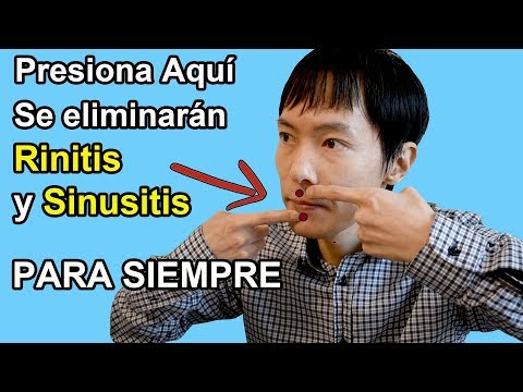 Elimina la Sinusitis y Rinitis para siempre con esta Acupresión genial