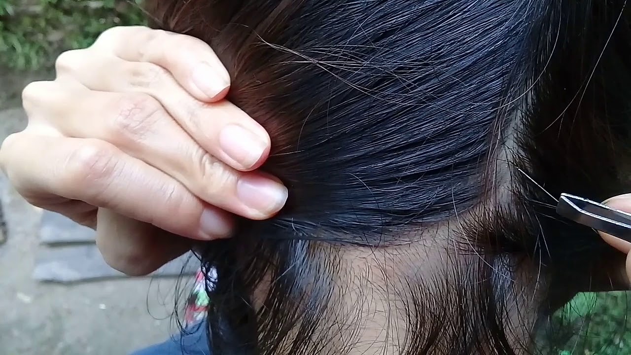 Pluck white hair on the head that makes the head very itchy YouTube