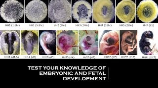 TEST YOUR KNOWLEDGE OF EMBRYONIC AND FETAL DEVELOPMENT