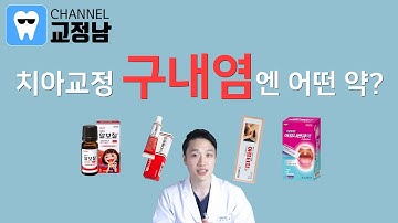 치아교정 구내염 치료엔 어떤 약? 잇몸 헐었을 때 구내염약 총정리! 치아교정불편감 해결방법!