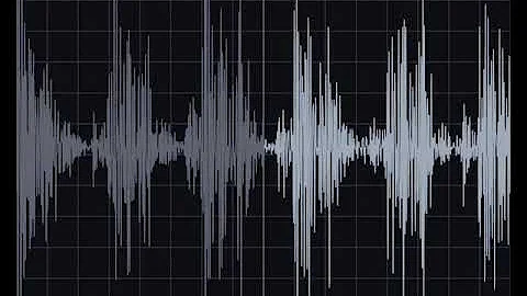 Waveform Wednesday: Austin Flint Murmur