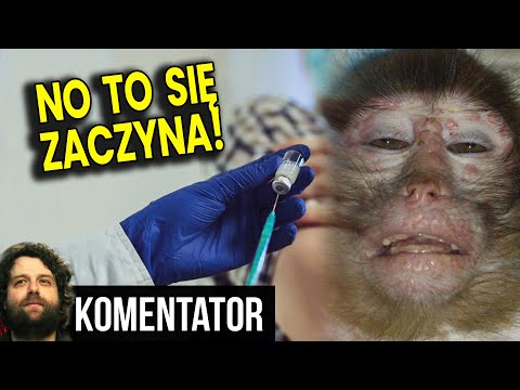 Małpia Ospa! Zaczyna Się! Obowiązkowa Kwarantanna! Szczepionki i Lek Już Są! Lockdown? Analiza Ator