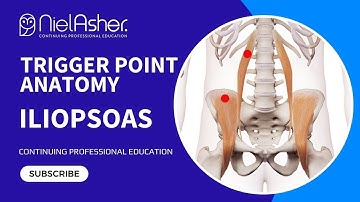 Exploring the Iliopsoas: Understanding Trigger Point Locations for Better Muscle Health