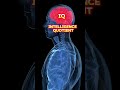 अगर तुम्हारा IQ 130 से ज़्यादा है, तो तुम दुनिया के 2% जीनियस में आते हो! 😱 | #IQ level explain #IQ