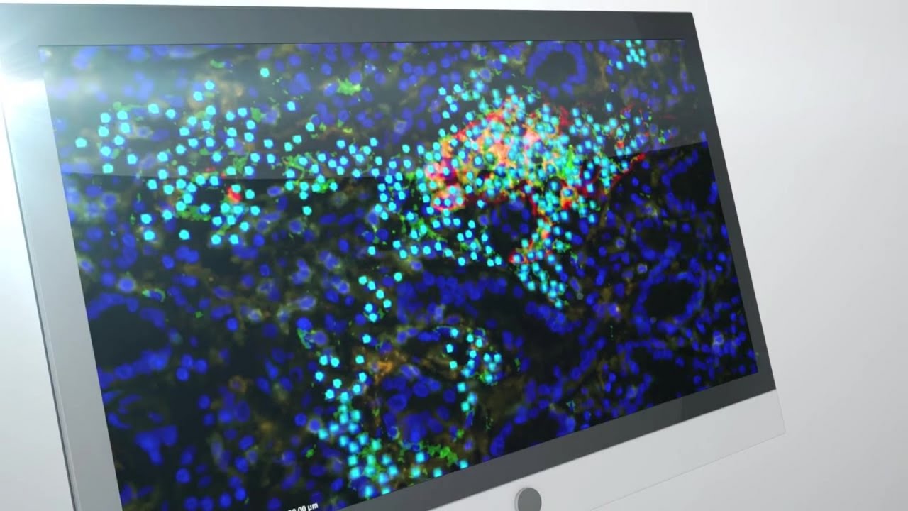 AI Spatial Biomarker Analysis from Multiplex Immunofluorescence Images ...