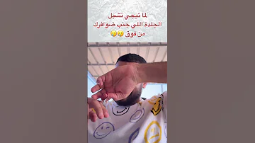 لما تيجي تشيل الجلدة اللي جنب ضوافرك من فوق 