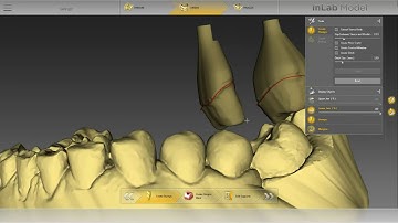 FR-WEB-inlab-sw-18-0-creation-modele-bridge.mp4