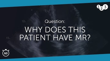 60 Seconds of Echo Teaching Question: Why does this patient have MR?