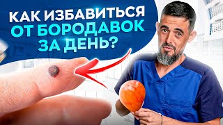 Как Избавиться От Папиллом И Бородавок За Сутки? Никак!