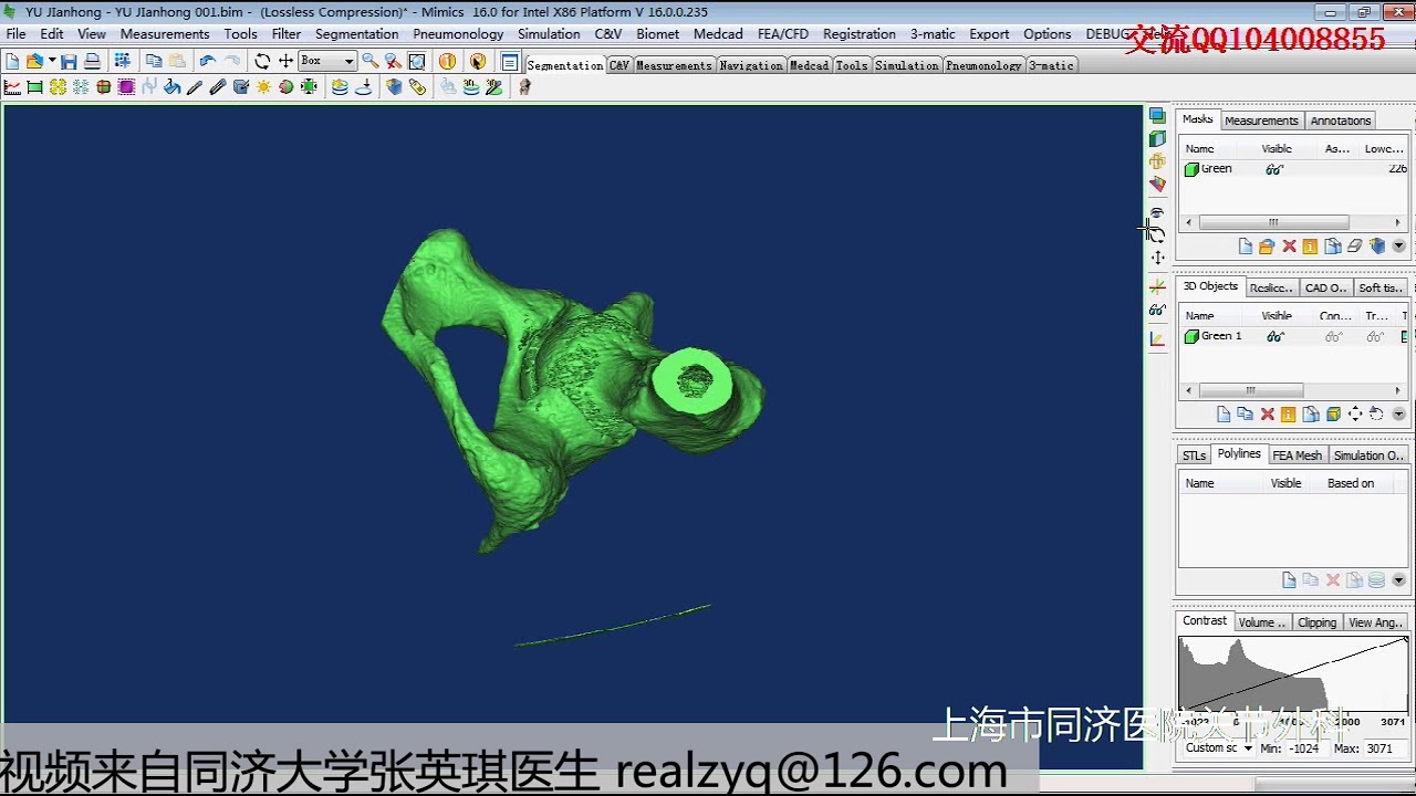 mimics中文视频教程 002 简单建模和操作 转2 - YouTube