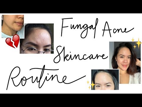 MALASSEZIA FOLLICULITIS/FUNGAL ACNE (Tiny Forehead Bumps) - My Skincare Routine | jskavee