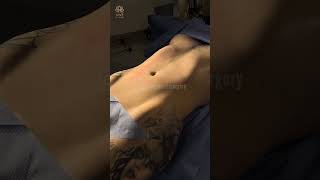 Body Goals Reached💕Lipo & BBL🍑 at Vive Plastic Surgery #tijuana 🤩