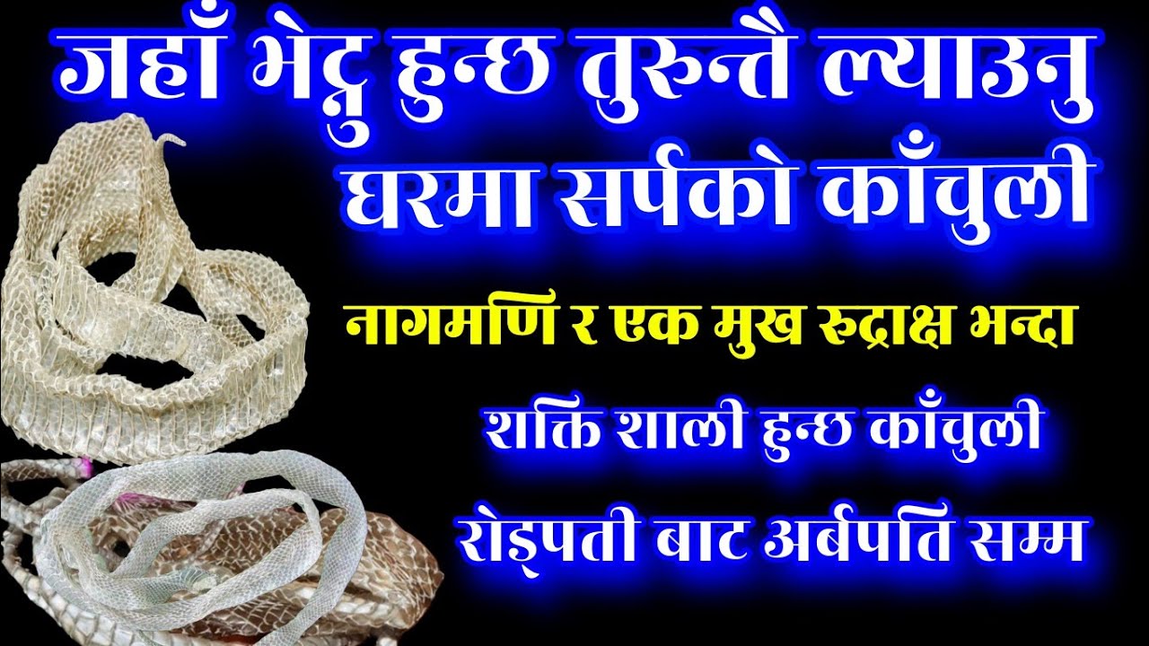 सर्पको काँचुलीबाट अर्बपति सम्म, रातारात धनी भाग्य चम्किन्छ, Sarpko kachuli baat bhagya udya, Kachuli